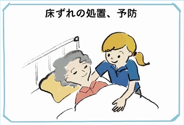 床ずれの処理、予防